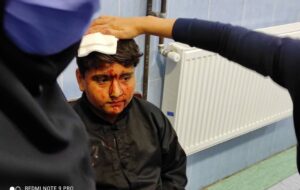 امداد رسانی سریع  نیاز ضروری زلزله زدگان سی سخت است