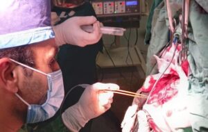 عمل موفقیت آمیز نادر مغز در بیمارستان شهید بهشتی یاسوج