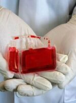 افزایش ۱۵ درصدی ذخیره خون بندناف در ایلام