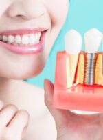 آشنایی با انواع روش های ترمیم دندان